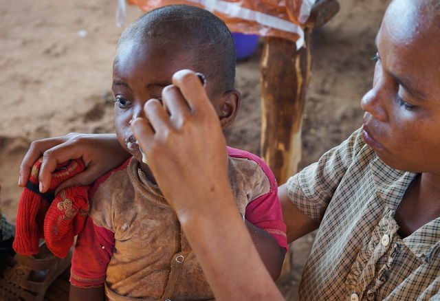 Across Africa, children could be at higher risk of malnutrition due to higher temperatures.