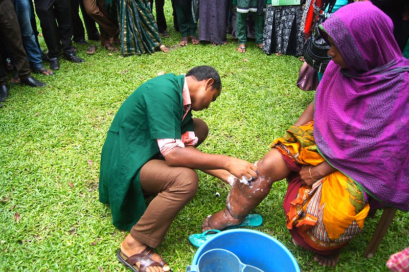 A Bangladeshi health worker demonstrates leg hygiene, one of the main strategies to reduce suffering from lymphatic filariasis.