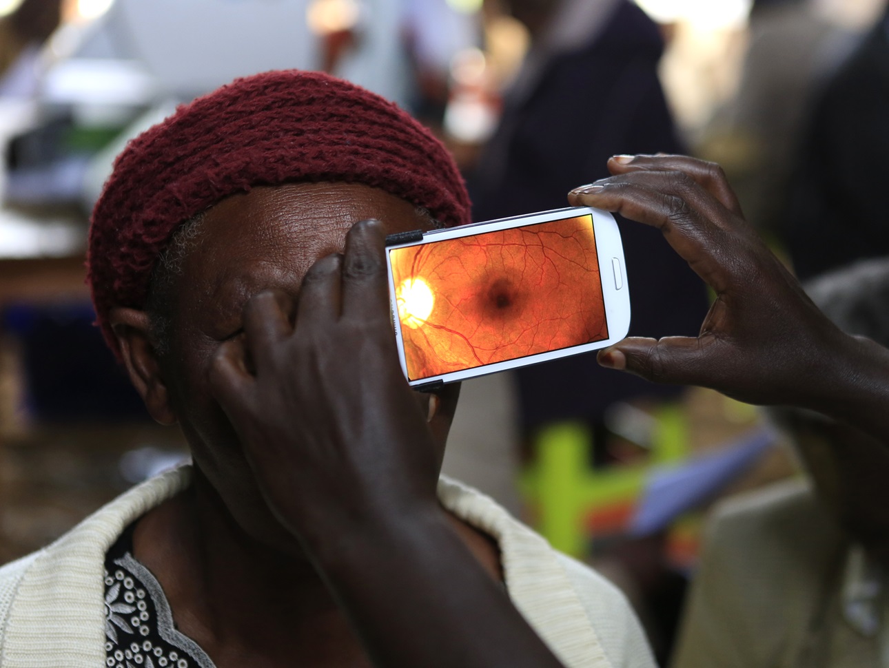 A woman undergoes an eye examination using a smartphone in Kenya.